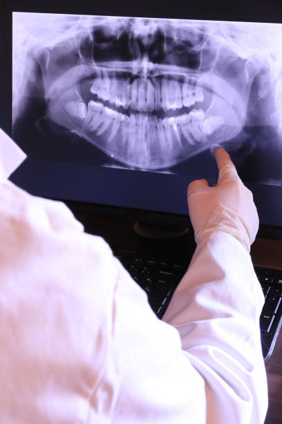 Best Broken or Cracked Tooth Emergency Dentist in Downingtown, PA